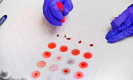 Ученые определили наиболее устойчивую к коронавирусу группу крови
