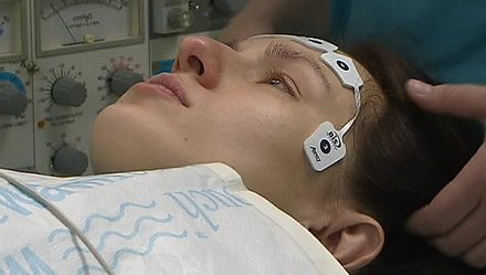 Детские нейрохирурги Беларуси освоили операции на мозге пациентам в сознании