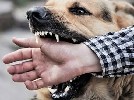 В Вороновском районе с начала года 36 человек обратились в медучреждения по поводу укусов животными