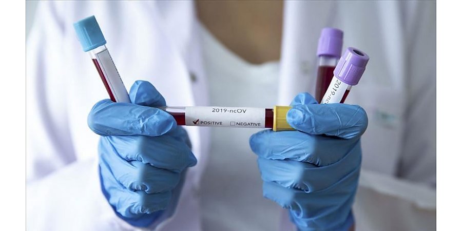 На Кипре обнаружен гибрид штаммов дельта и омикрон