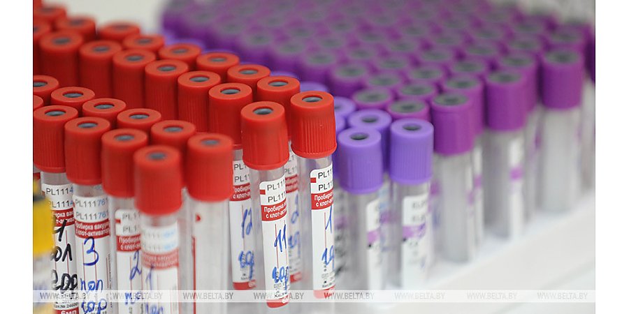 За сутки в Беларуси зарегистрированы 5663 пациента с COVID-19, выписаны 1476