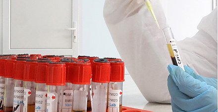 Низкий уровень физической активности почти удвоил риск гибели от COVID-19