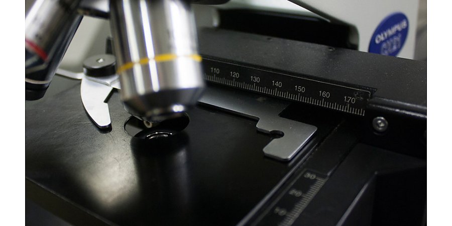 Смертность до 90%: первооткрыватель Эболы предупредил о новой опасной болезни