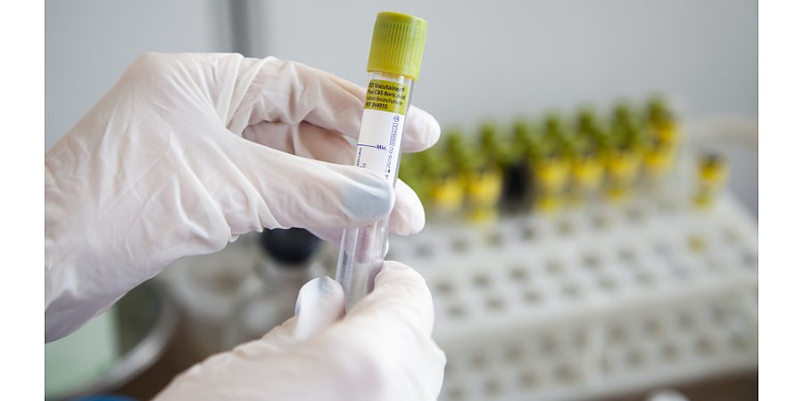 Ученые раскрыли опасность «британского» штамма коронавируса