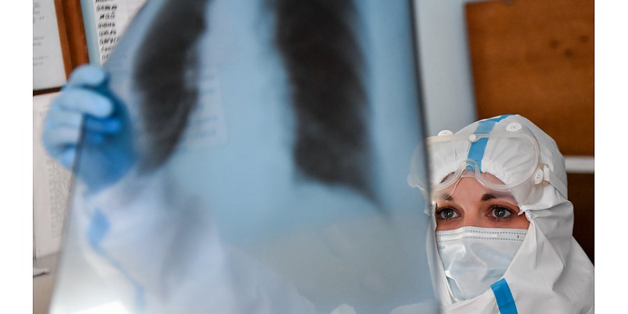 Ученые обучили нейросеть выявлять коронавирус по рентгеновским снимкам