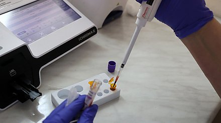 В Лидском районе лабораторно подтвержден случай кори