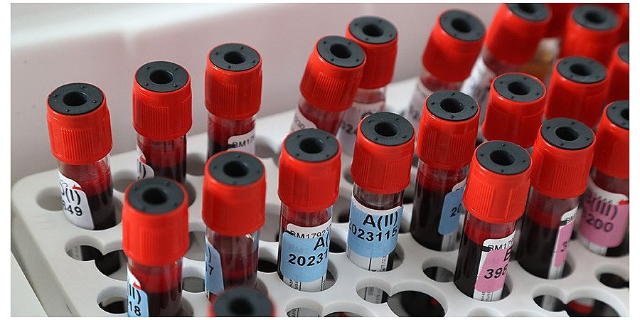 За сутки в Беларуси зарегистрированы 1456 пациентов с COVID-19, выписаны 1754