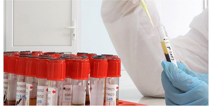 Низкий уровень физической активности почти удвоил риск гибели от COVID-19