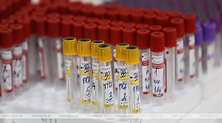 Белорусские медики рассказали о подготовке ко второй волне коронавируса
