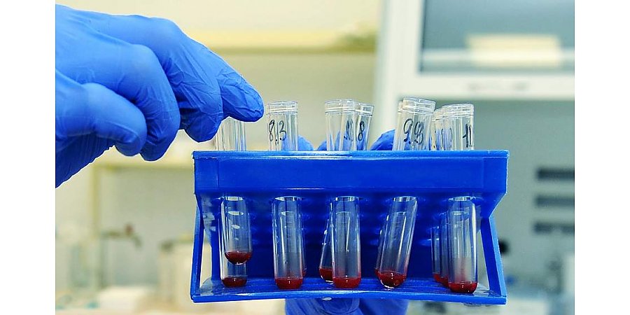 Боремся с раком по-белорусски. Как отечественный противоопухолевый продукт на основе клеток-киллеров стал прорывом в медицине