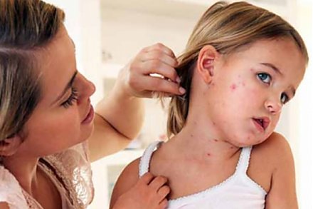 Корь. Защищаемся грамотно