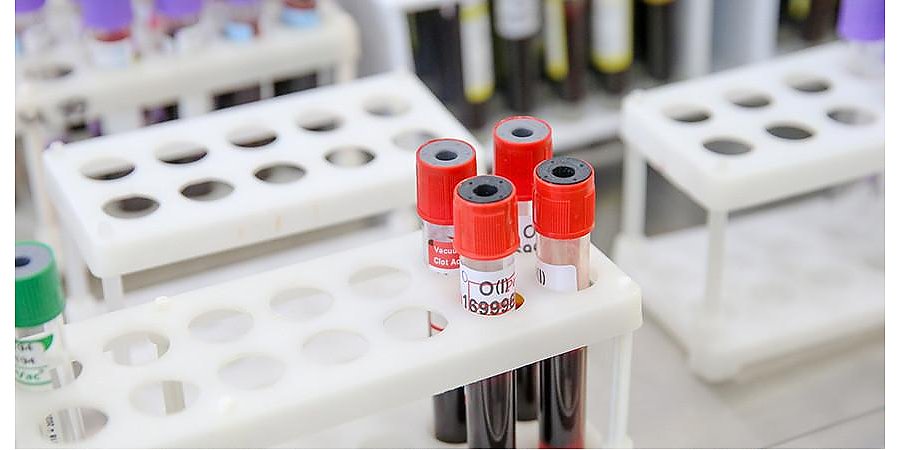 За сутки в Беларуси зарегистрированы 1887 пациентов с COVID-19, выписаны 1534