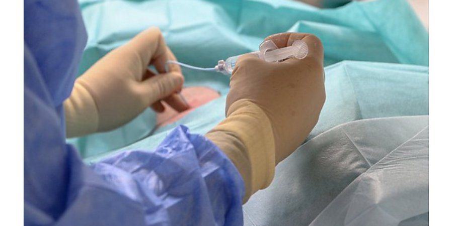 Разработан прототип устройства для лечения рака микроволновым излучением