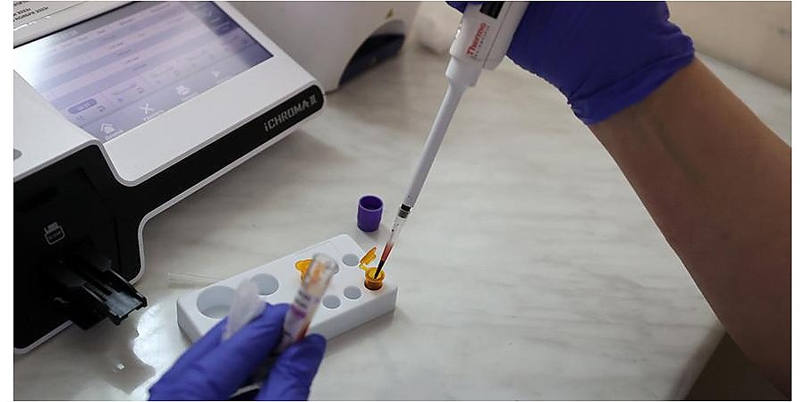 За 10 месяцев 2023 года в Гродненской области обнаружено 90 новых случаев заражения ВИЧ-инфекцией