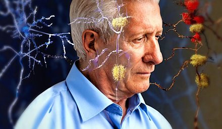 Ученые: негативные мысли приводят к развитию болезни Альцгеймера