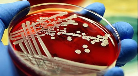 Ученые изобрели антибиотик, умеющий уничтожать современных микробов