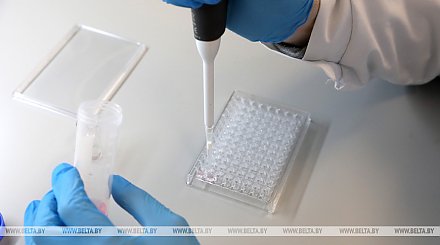 Витебская компания запустила производство тестов на COVID-19