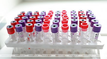 В Беларуси выздоровели и выписаны 63 163 пациента с COVID-19