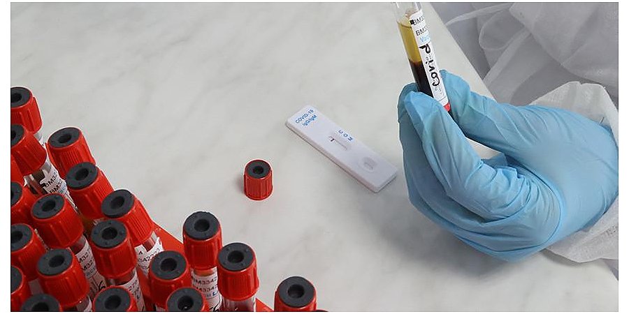 За сутки в Беларуси зарегистрированы 1910 пациентов с COVID-19, выписаны 2638