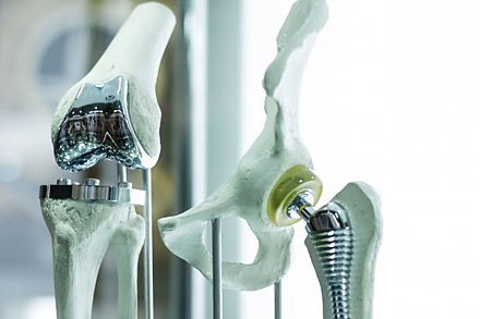 В Минздраве рассказали про очередь на замену суставов и изменения в ценообразовании