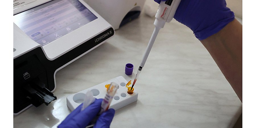 В Лидском районе лабораторно подтвержден случай кори