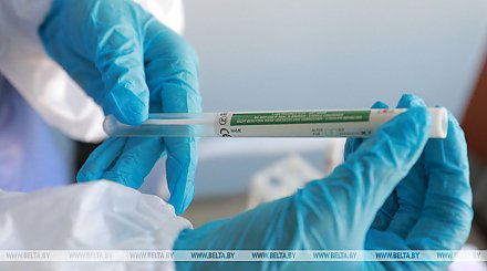 В Беларуси провели более 86,8 тыс. тестов на коронавирус