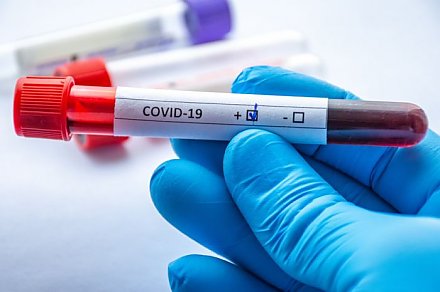 Как реагирует на коронавирус наша кровь и какую информацию об инфекции выдают ее анализы