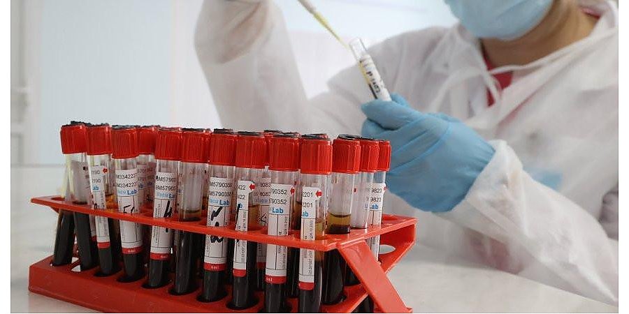 Пандемия COVID-19 уйдет не раньше, чем через два-три года - эксперт