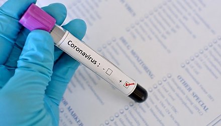 Получен положительный лабораторный результат на коронавирус у пациентки областной инфекционной больницы