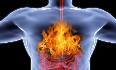 4 продукта, которые помогут справиться с изжогой