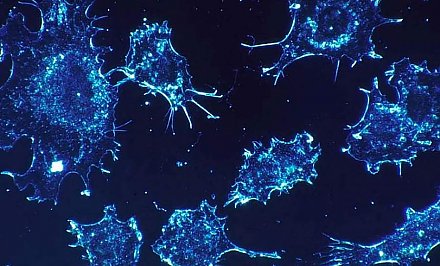 Российские ученые создали наноробота, убивающего раковые клетки