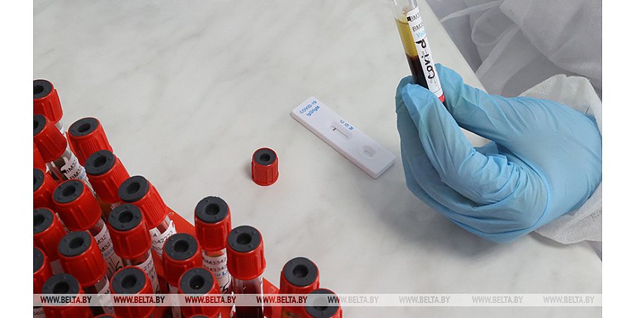 За сутки в Беларуси зарегистрированы 493 пациента с COVID-19, выписаны 215