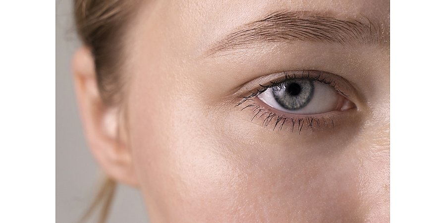 Из-за чего могут отекать веки? Офтальмолог назвала возможные причины