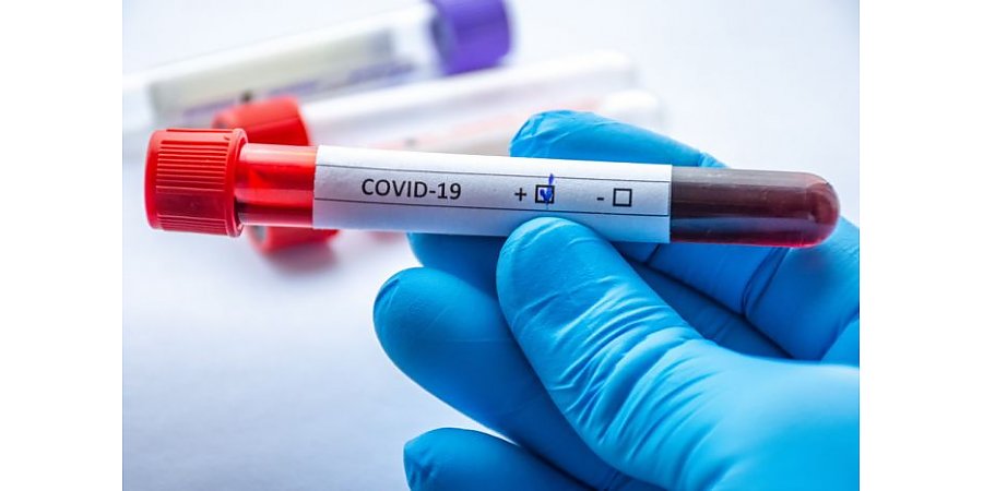 Как реагирует на коронавирус наша кровь и какую информацию об инфекции выдают ее анализы