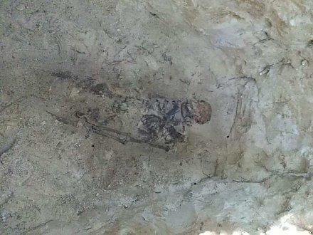 В Берестовицком районе обнаружено массовое захоронение периода Первой мировой войны