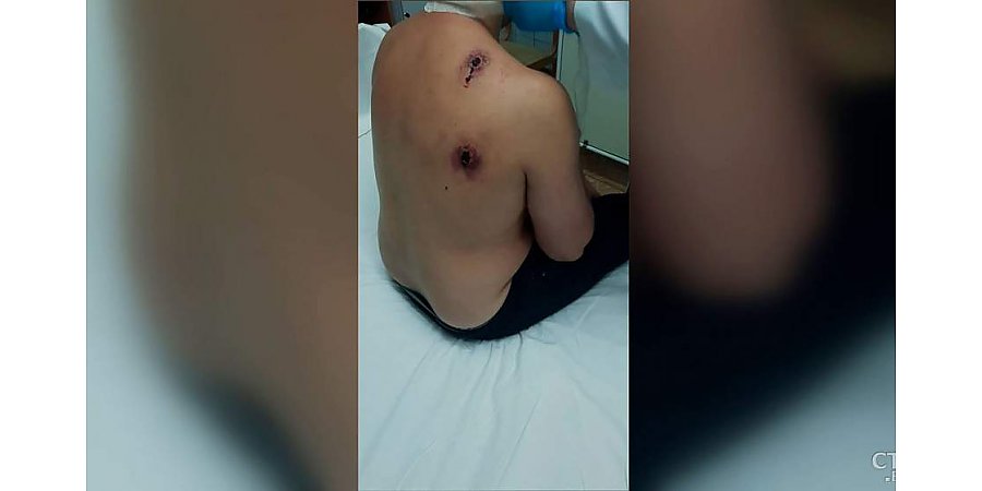 На телах мигрантов – раны от пуль. Кадры с белорусско-литовской границы