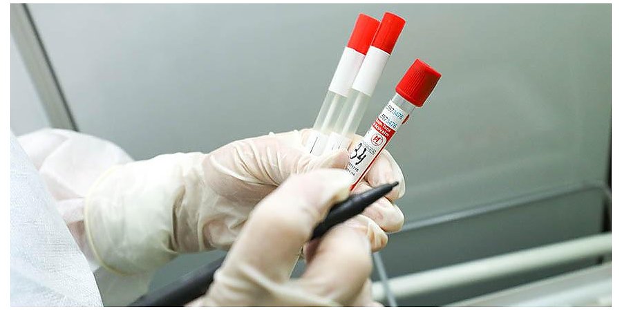 За сутки в Беларуси зарегистрированы 983 пациента с COVID-19, выписаны 1236