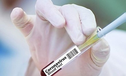 Минздрав: более 20 тысяч тестов на коронавирус проведено в Беларуси с января