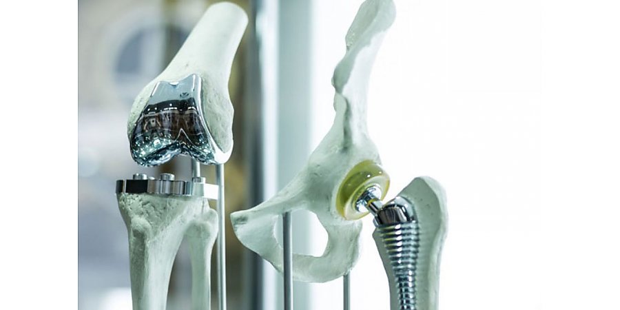 В Минздраве рассказали про очередь на замену суставов и изменения в ценообразовании