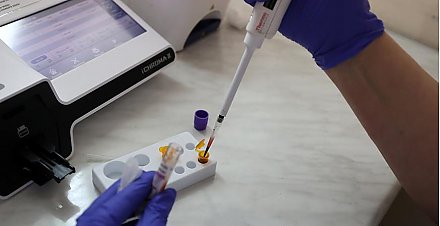 За 10 месяцев 2023 года в Гродненской области обнаружено 90 новых случаев заражения ВИЧ-инфекцией