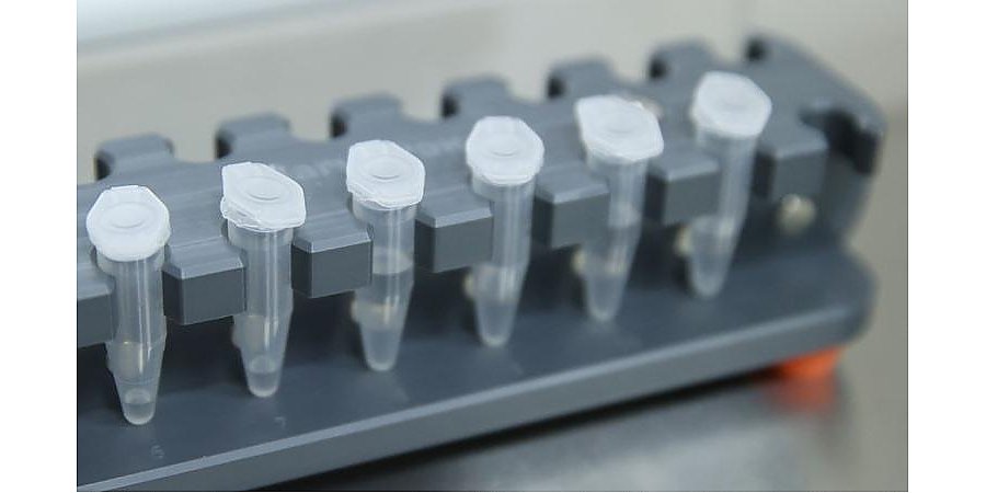 За сутки в Беларуси зарегистрированы 1696 пациентов с COVID-19, выписаны 2000