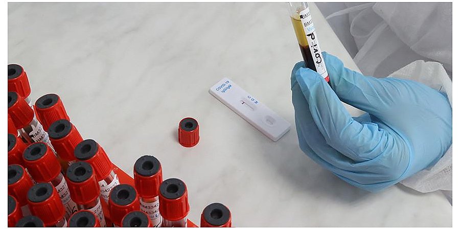 Гинцбург рассказал о появлении нового коронавируса NeoCov в ЮАР