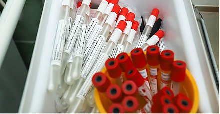В ВОЗ сообщили, что ПЦР-тесты распознают новый штамм коронавируса